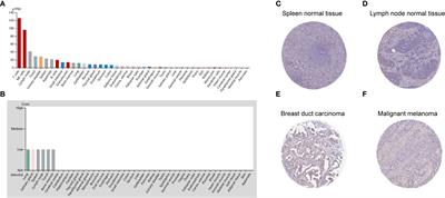 CD96 Correlates With Immune Infiltration and Impacts Patient Prognosis: A Pan-Cancer Analysis